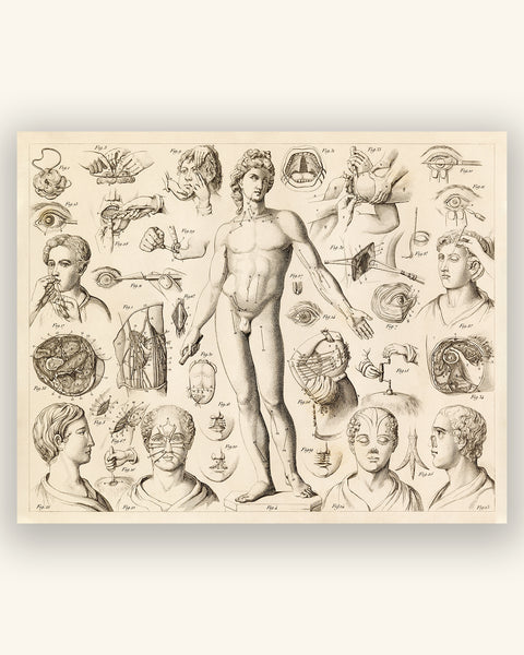 Antique Surgery Print - Various Surgical Operations