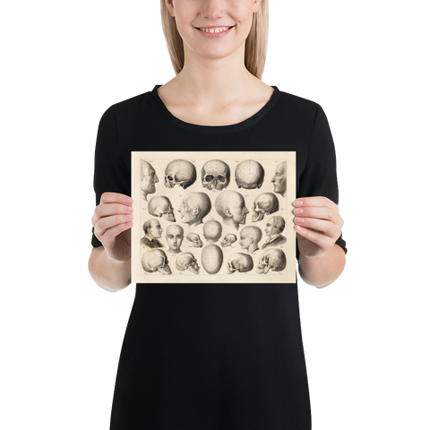 Vintage Human Anatomy Print - Psychology Relations to the Brain